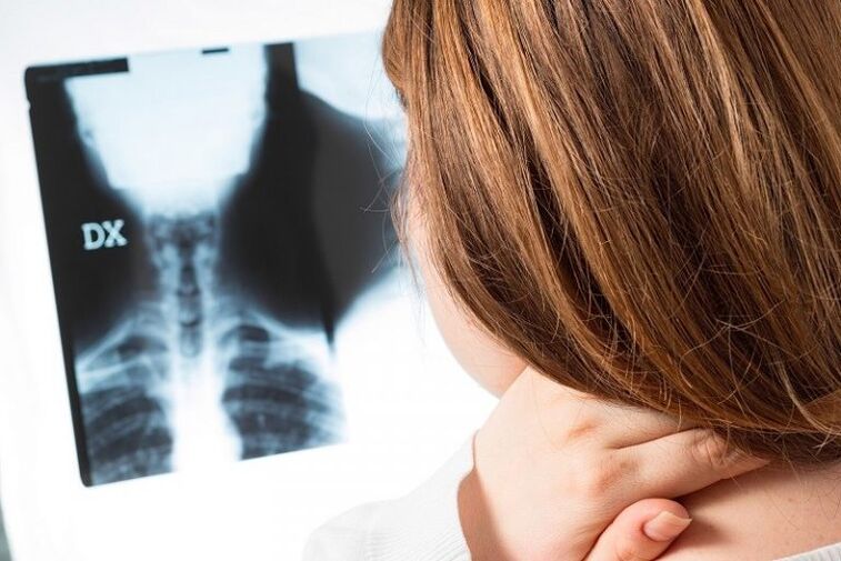 საშვილოსნოს ყელის რეგიონის x -ray